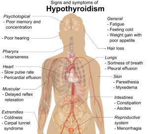 Hypothyroidism treatment